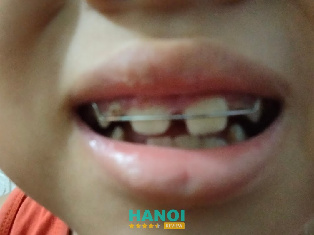 Nha Khoa Gia Đình hình ảnh 2