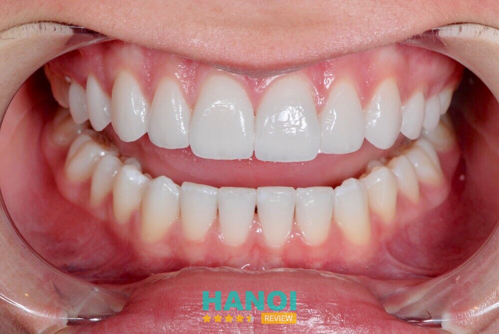 Nha khoa 108 (Sơn Đồng - Hoài Đức) hình ảnh 2
