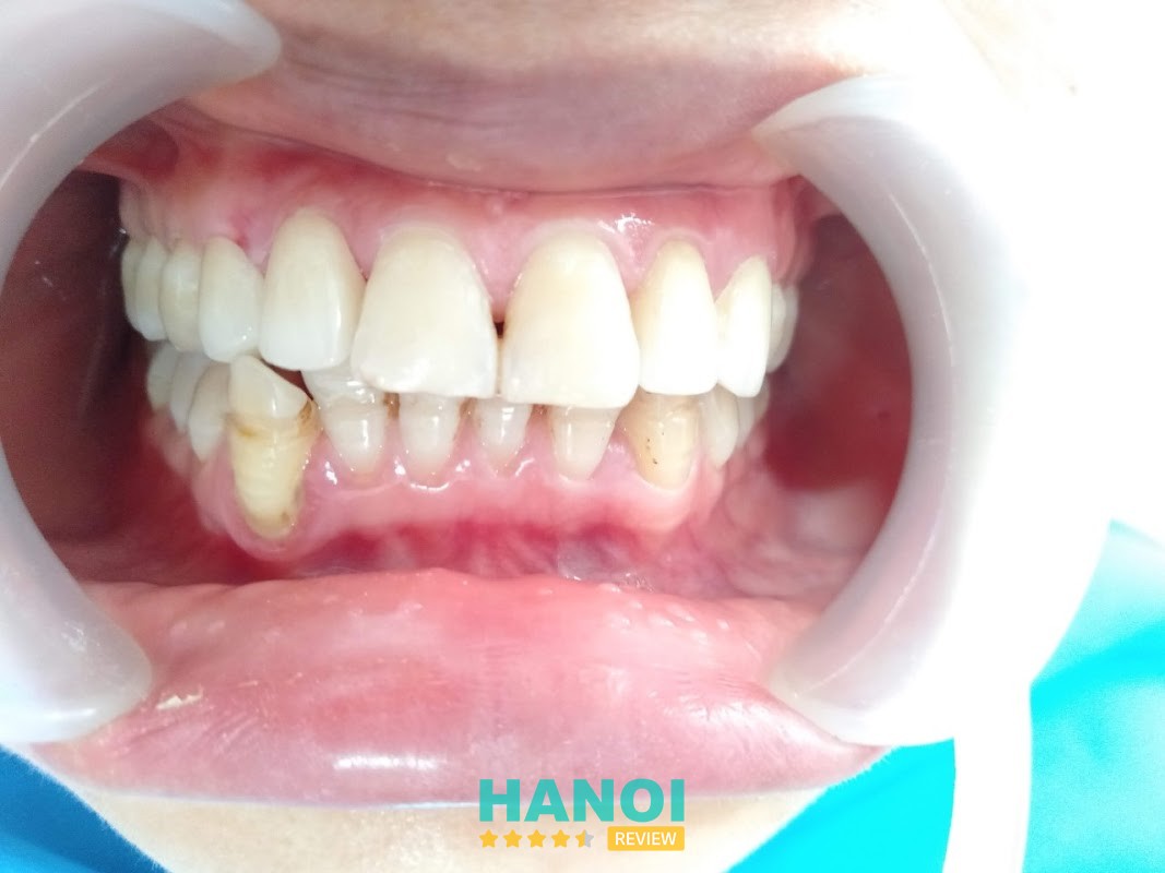 Nha Khoa Minh Nhật - BS CKI Nguyễn Văn Huỳnh hình ảnh 3