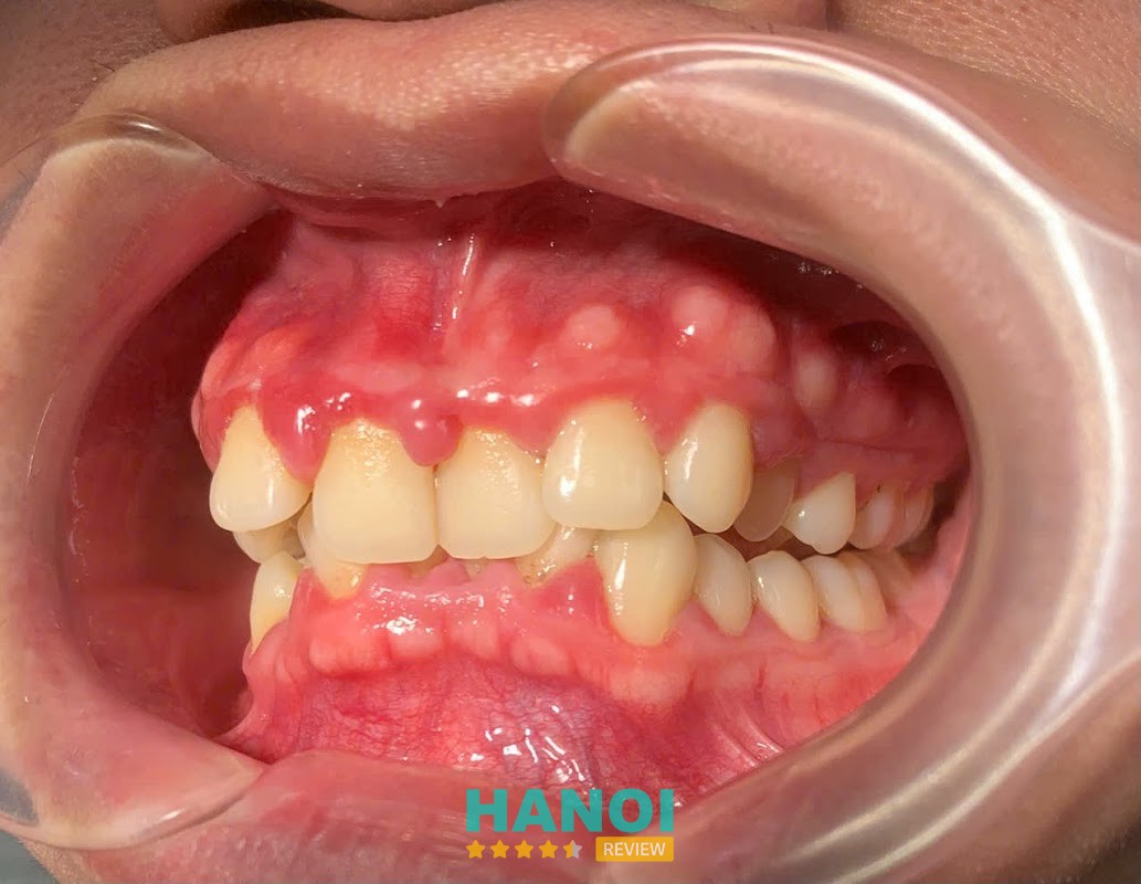 Nha Khoa Việt Mỹ hình ảnh 2